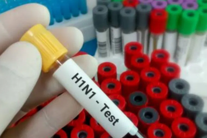 ಬೆಂಗಳೂರಿನಲ್ಲಿ ಹೆಚ್ಚುತ್ತಿದೆ ಹಂದಿ ಜ್ವರ