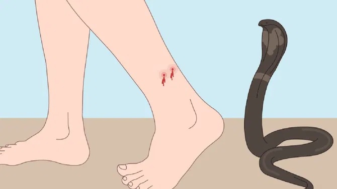 ಬೀದಿ ನಾಯಿ ಮತ್ತು ಹಾವು ಕಡಿತ ಹೆಚ್ಚಳ: 10 ತಿಂಗಳಲ್ಲಿ 18 ಸಾವಿರ ಕೇಸ್ ಬೀದಿ ನಾಯಿ ಮತ್ತು ಹಾವು ಕಡಿತ ಹೆಚ್ಚಳ: 10 ತಿಂಗಳಲ್ಲಿ 18 ಸಾವಿರ ಕೇಸ್